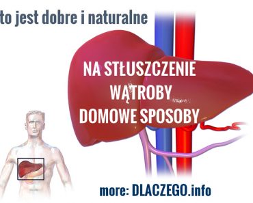 dlaczego.pl-stluszczenie-watroby-leczenie-naturalne