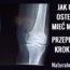 naturalnesposoby.pl-osteoporoza-jak-uniknac-przepis