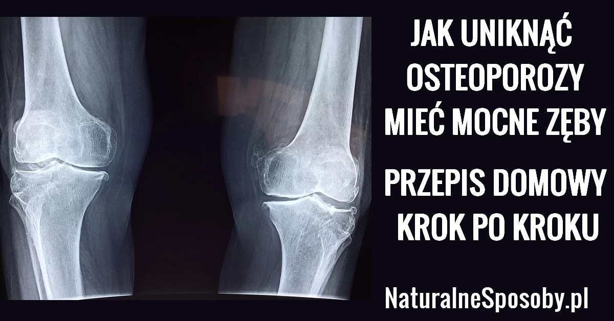 naturalnesposoby.pl-osteoporoza-jak-uniknac-przepis